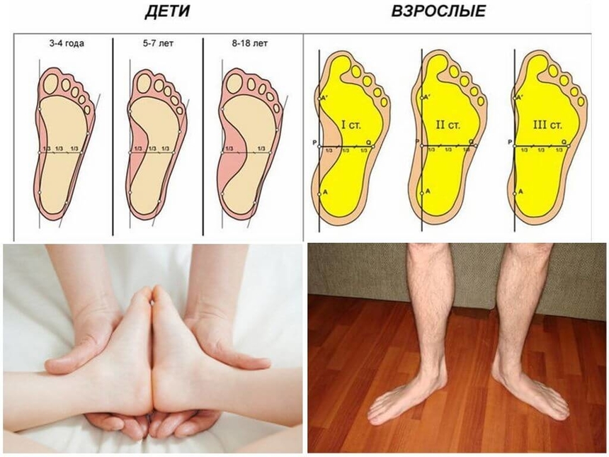 Как подобрать ортопедическую обувь для детей в Новосибирске и не только -  Моя газета | Моя газета