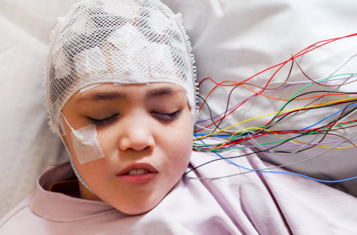 Эпилепсия у детей - причины и лечение