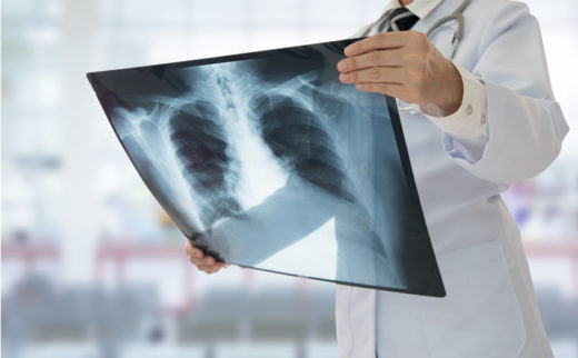Рентгенография: что это, особенности и преимущества процедуры