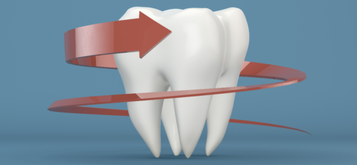 Реминерализация – как укрепить зубную эмаль?