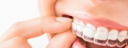 Исправление зубного прикуса: советы ортодонта
