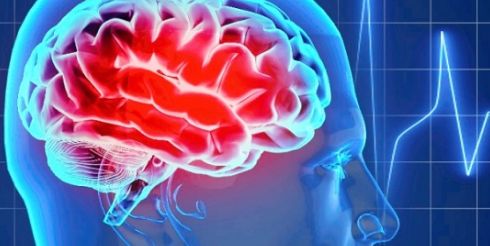 Разработан новый метод реабилитации после инсульта