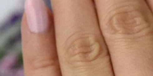 Женские кольца из белого золота — лучшие ювелирные украшения