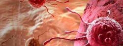 Связь рака с группой крови: факты и мифы