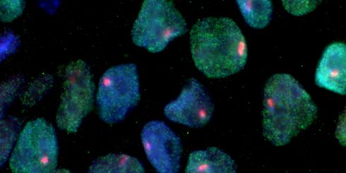 Американские ученые получили стволовые клетки путем клонирования