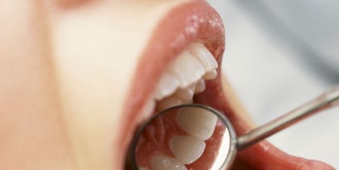 Как правильно следить за зубами