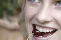 Почему так важно хорошее состояние зубов