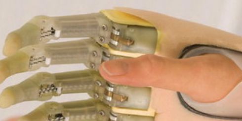 Киборги наступают, бионические пальцы ProDigits